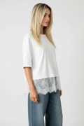 Editorial 2 – Side Profile